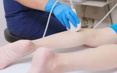 Traitement des varices par échothérapie HIFU