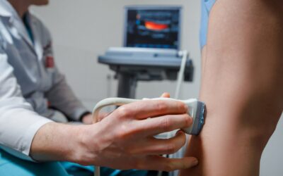 Écho-Doppler veineux : comment se déroule l’examen des jambes ?